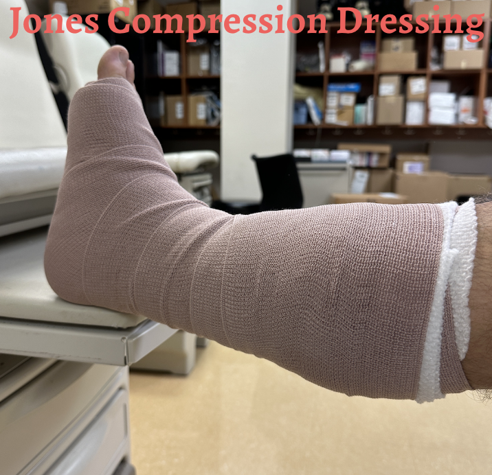 How To Apply a Jones Compression Dressing