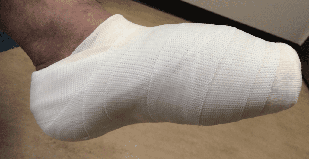 How To Apply A Slipper Cast: A Step-by-Step Guide